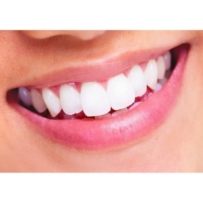 Отбеливание зубной эмали: чем оно отличается от аппаратной чистки 